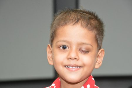 Indian boy receives life-saving eye cancer treatment through Operation Eyesight