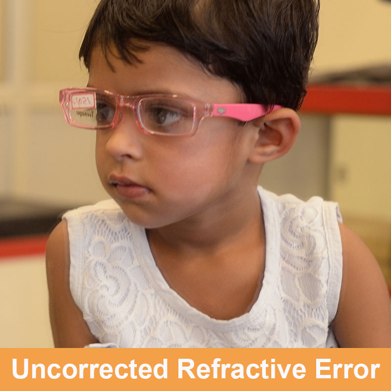 Uncorrected Refractive Error